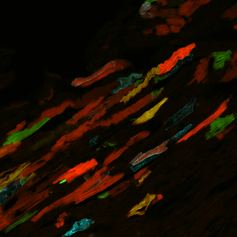 Confocal microscopy used to visualize “confetti”-tagged cardiomyocytes.