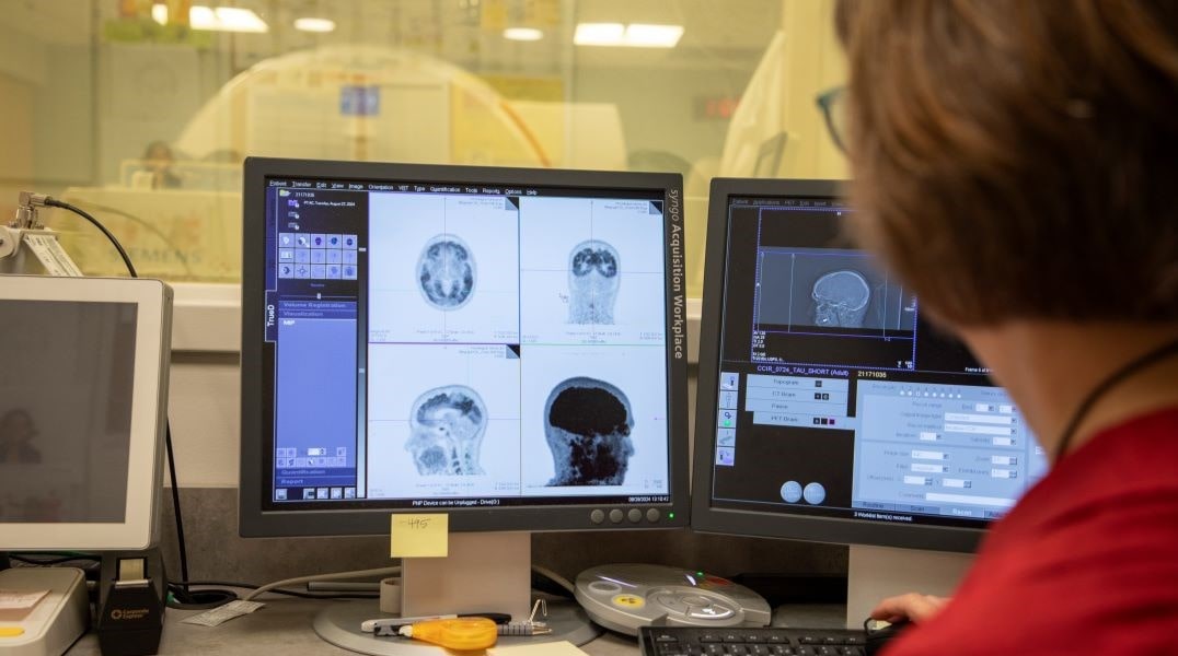 Dr. Tammie Benzinger visualizes brain structures