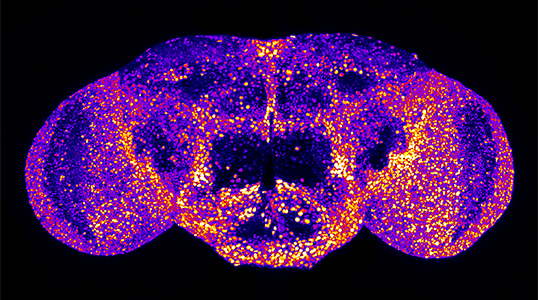 Visualization of fry gene expression in an adult fly brain.