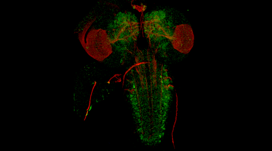 Fluorescent microscopy image showing a fruit fly larval brain.