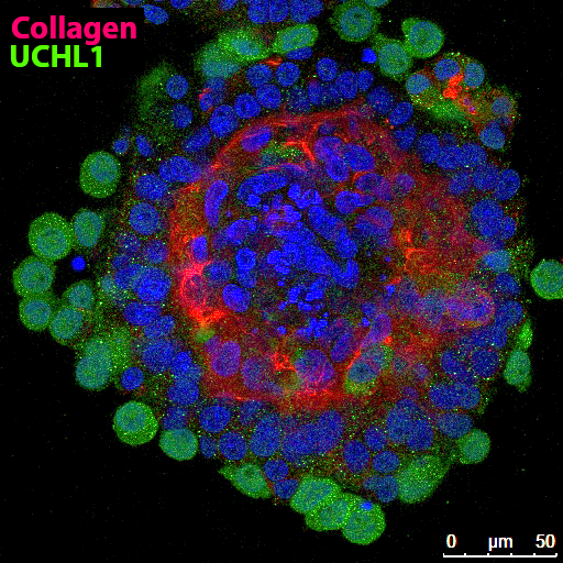 Infusion of donor cells into the rete testis via a catheter placed by ultrasound guidance. Photo courtesy of Dr. Ina Dobrinski, University of Calgary.