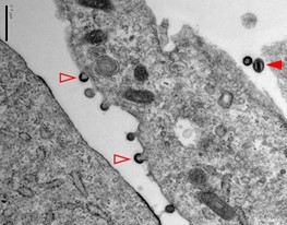 Transmission electron microscopic image.