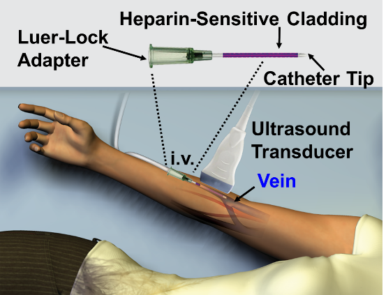  Real-time monitoring of heparin with the drug-selective catheter.
