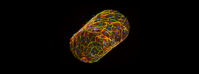 3 D engineered endothelial blood vessel captured with Airyscan on the LSM 880 confocal microscope. Image courtesy of John Sperduto, Slater Laboratory, University of Delaware.