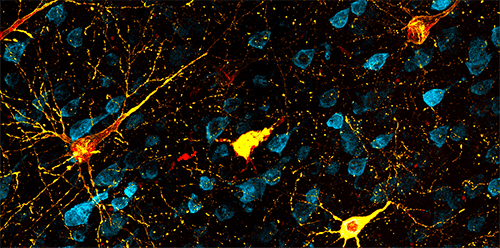 Confocal microscopy image of the rhesus macaque brain