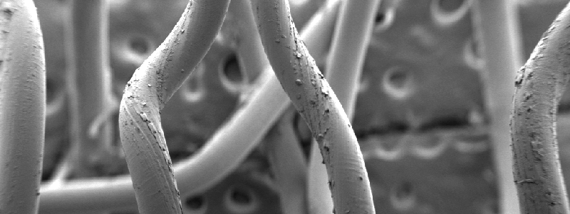 Scanning electron microscopy is used to visualize twisting of poly(l-lactic acid) fibers in the central coil of a fully expanded stent. Image courtesy of Dr. Annie Nguyen, Welch Laboratory, UT Southwestern.