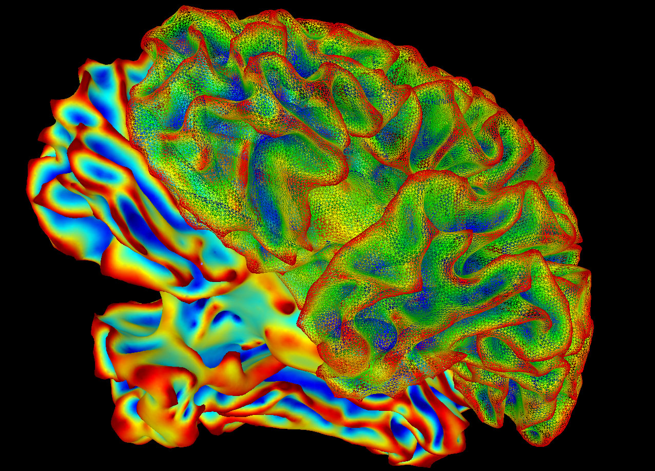 Multicolor image of the whole brain.