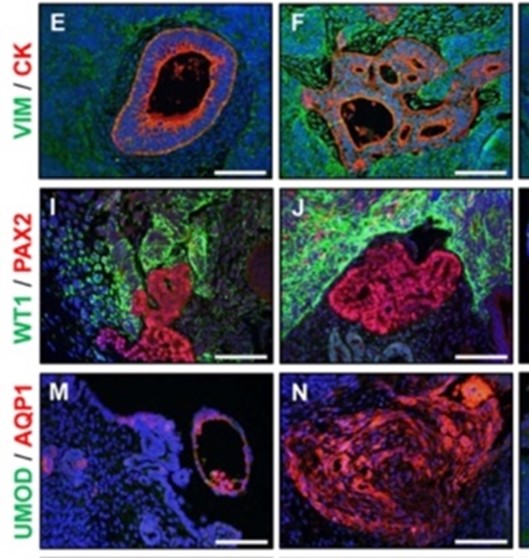 Differentiating pluripotent cells.