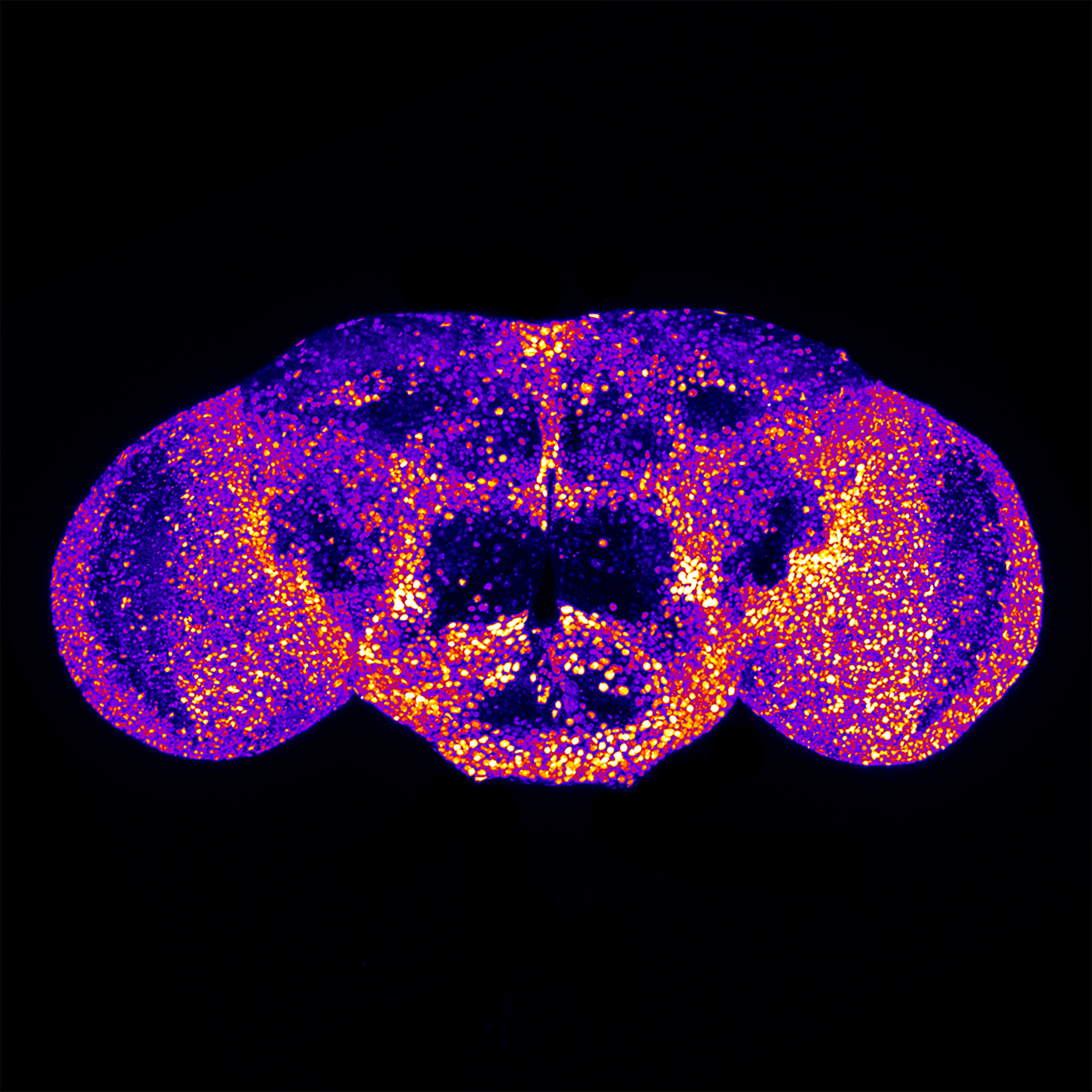 Visualization of fry gene expression in an adult fly brain.