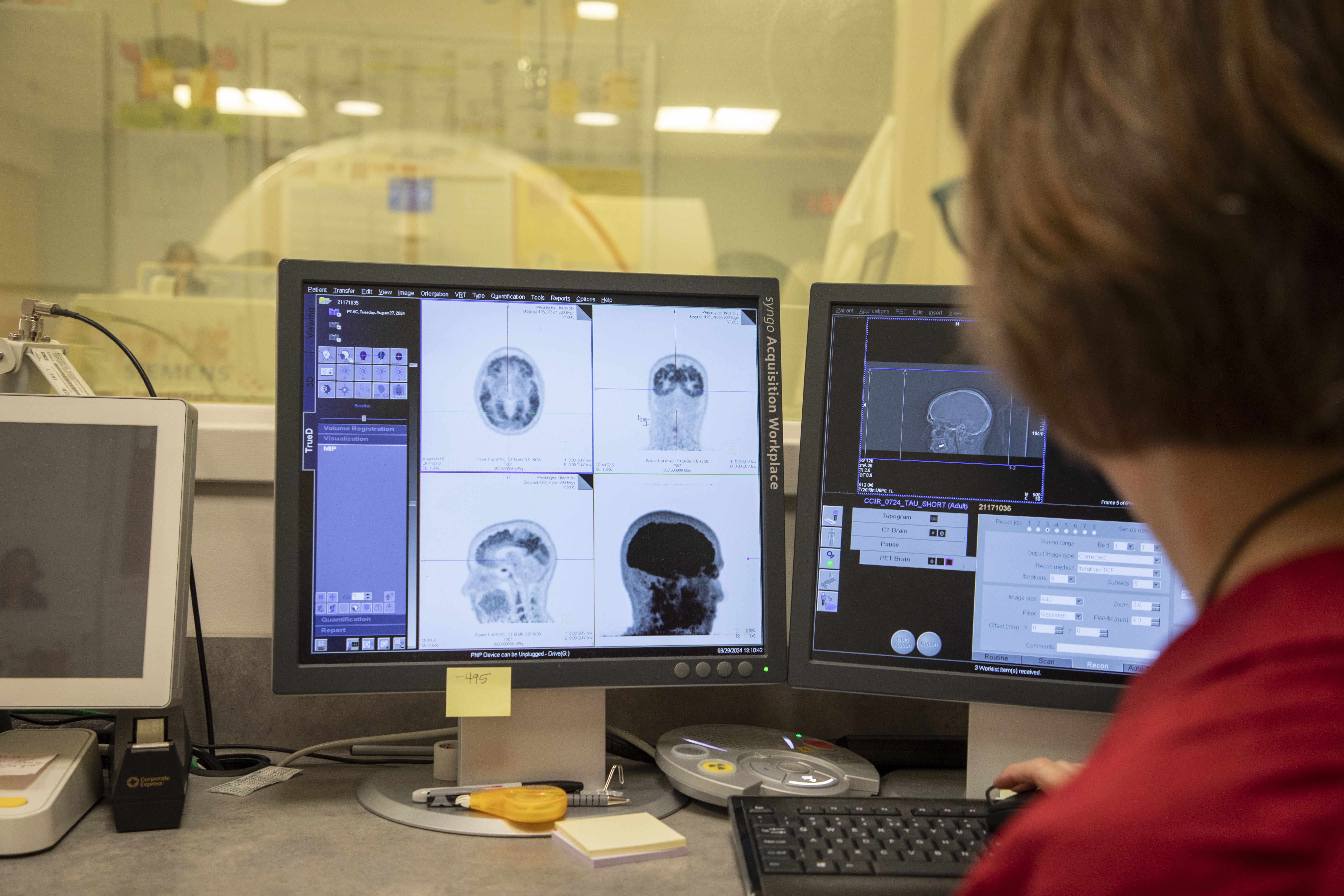 Dr. Tammie Benzinger visualizes brain structures at the Center for Clinical Imaging Research