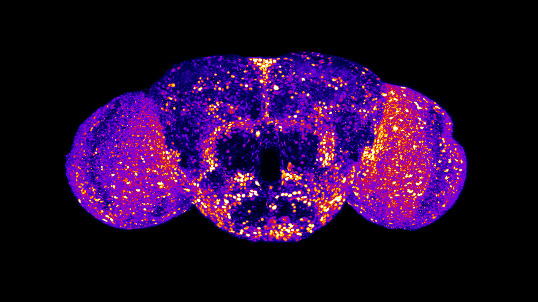 Visualization of UBA5 expression in an adult fly brain.