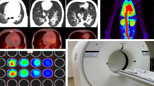 Ultrasound, bioluminescence, and total-body positron emission tomography/computed tomography images.