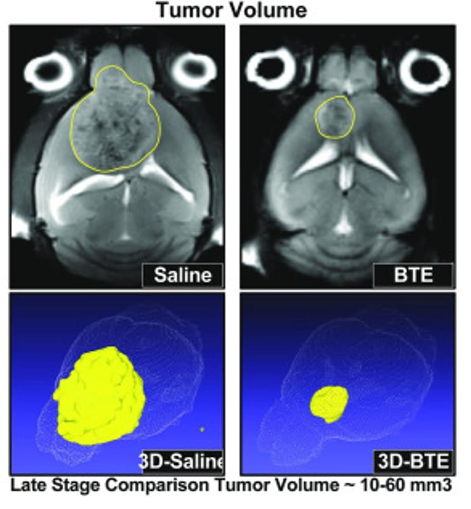 Magnetic resonance imaging images of tumor volume in the BTE treatment and control mice.